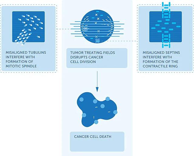 癌症生存率翻倍！以色列黑科技来华，有点神，也有点贵
