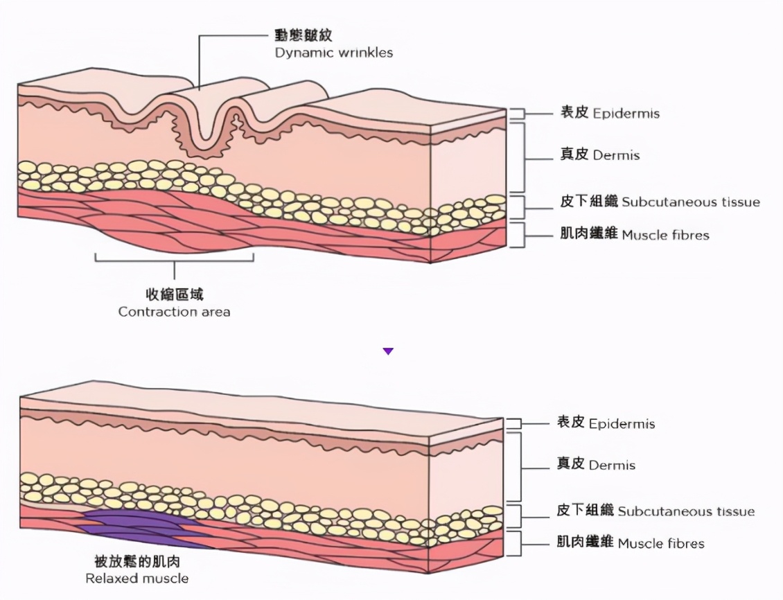 肉毒风起,医美云涌