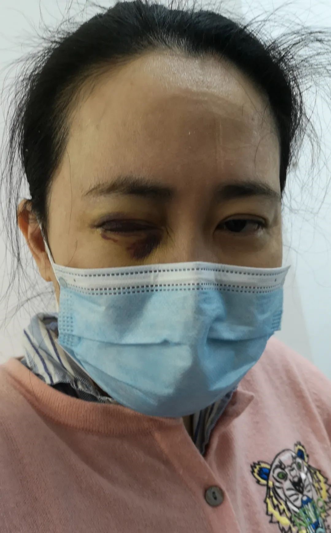 武汉抗疫医生曝光爱尔眼科行贿,“眼茅”光环背后乱象丛生