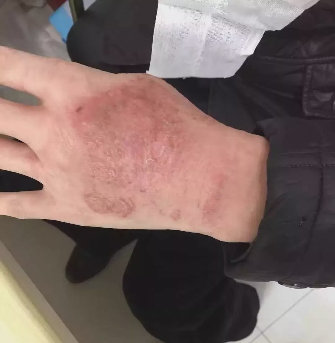 因为有你，所以英雄！ 